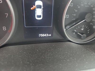 2017 Hyundai ELANTRA Limited DIAMOND IN THE ROUGH