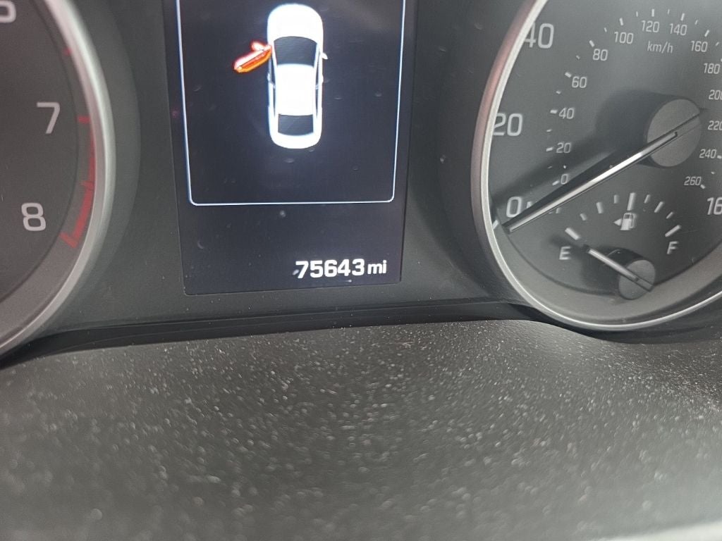 2017 Hyundai ELANTRA Limited DIAMOND IN THE ROUGH