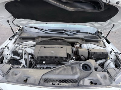 2025 Acura MDX Technology Package